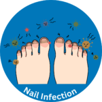 Nail Infectionwould infection Test